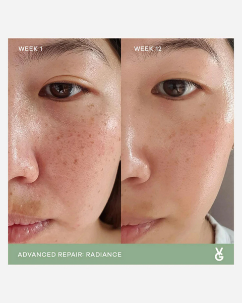 Vida Glow’s radiance capsule was formulated specifically to treat areas of hyperpigmented skin resulting in a more even complexion for overall skin tone perfection.