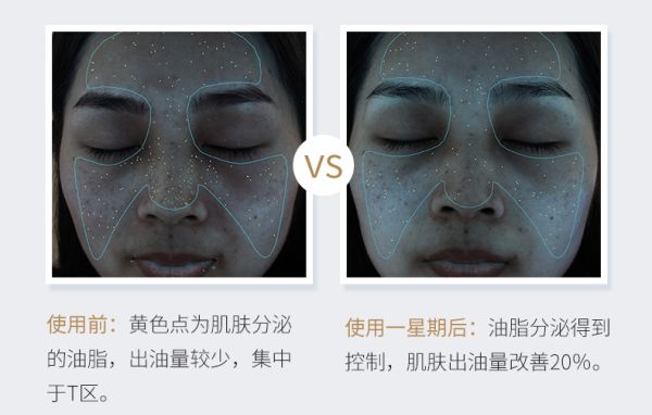 Mageline Ultimate Clear Facial Cleanser. Mild facial cleanser to clear the skin of any impurities, but keep it hydrated at the same time. Deep cleansing of pores, exfoliate and removal of makeup residual, dirt and dust. Designed for sensitive skin with a PH value of 5.5, mild and without irritation and does not give the skin any burden. It control oil secretion and also removes acne, soothes skin irritation and leaving the skin clean, soft and refreshed