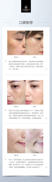 Mageline Whitening Spot Correcting Night Cream. It helps prevent and reduce fine lines, wrinkles, sagging, dark spots, and other visible signs of aging. Enhances blood circulation, revives dull skin, tighten skin, keeps skin supple and hydrated and modulates oil production. A myriad of herbal extracts penetrate the deep layers of skin to remove melanin pigment. Promotes skin metabolism and effectively prevents the formation of new freckes/dark spots