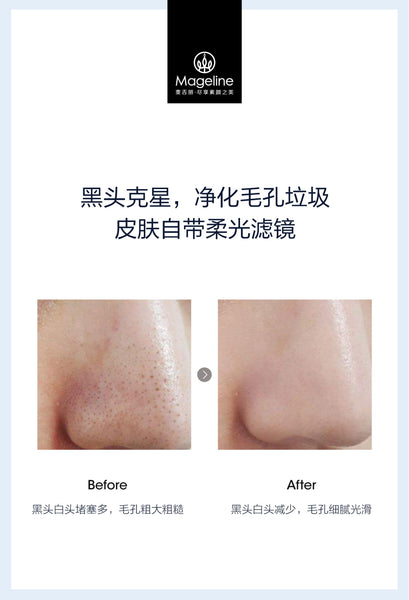 Mageline Magic Blackhead Remover Water (30ml) contains high-purity plant extracts, is gently formulated to dissolve blackheads, unclog pores, absorb excess oil and deep clean blemish-causing impurities. Designed to soothe irritated skin and shrink the appearance of pores for a more radiant, glowing complexion.