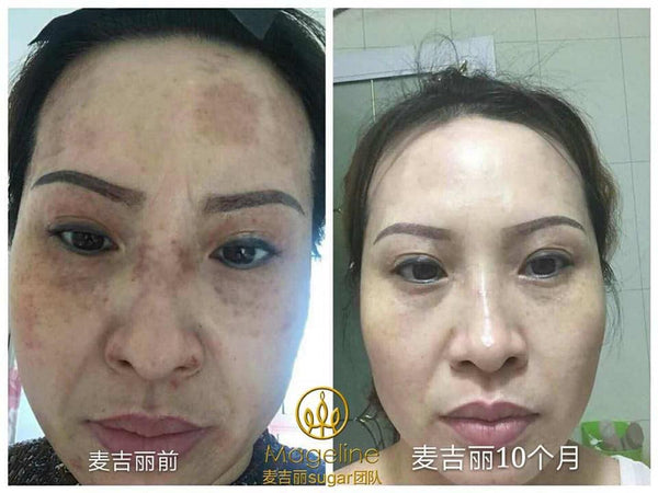 Mageline Whitening Spot Correcting Night Cream. It helps prevent and reduce fine lines, wrinkles, sagging, dark spots, and other visible signs of aging. Enhances blood circulation, revives dull skin, tighten skin, keeps skin supple and hydrated and modulates oil production. A myriad of herbal extracts penetrate the deep layers of skin to remove melanin pigment. Promotes skin metabolism and effectively prevents the formation of new freckes/dark spots