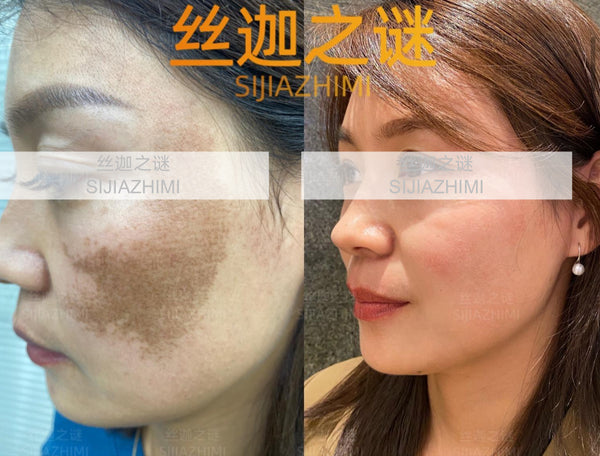 Spotless Bright · Ageless Glow 90-mins Facial