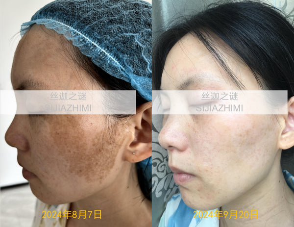 Spotless Bright · Ageless Glow 90-mins Facial