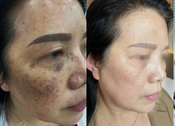 Spotless Bright · Ageless Glow 90-mins Facial