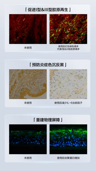 Mageline Medical Recombinant Collagen Patch